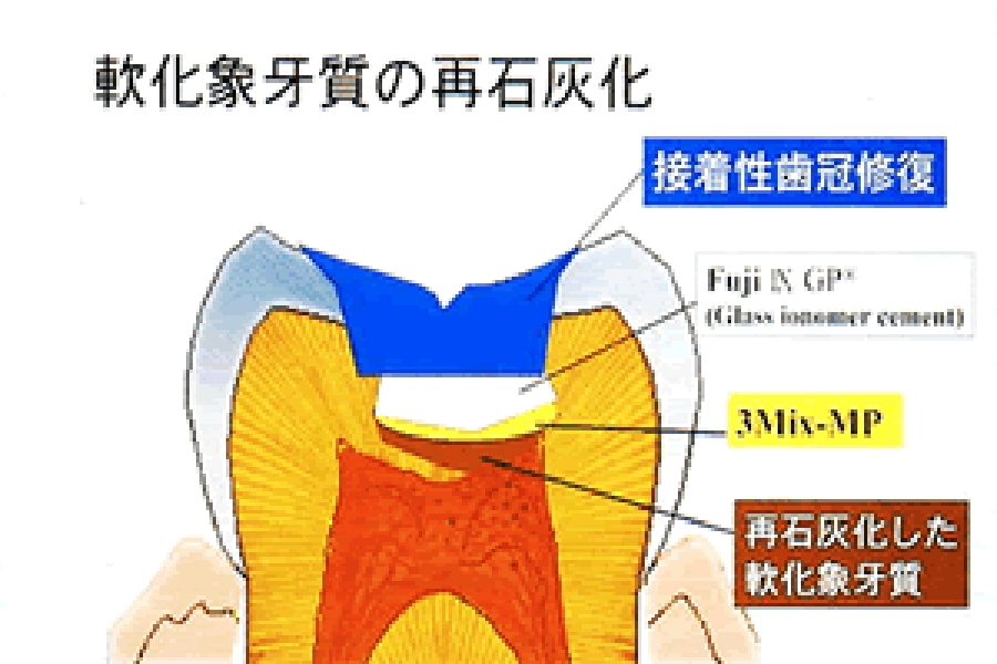 3mix-mpの画像