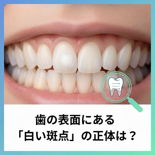ホワイトスポット